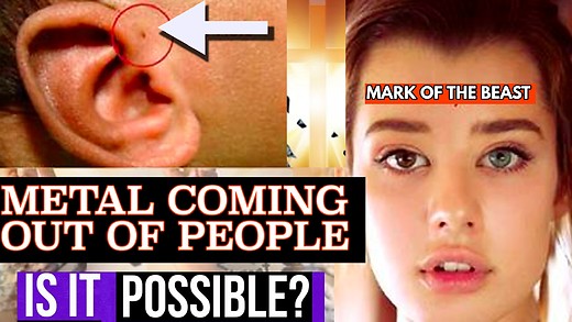 Will Our Bodies Reject "The Mark" If They Force Us To Take It? Are They Doing It NOW? Billy Hallowel